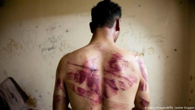 لماذا يصور نظام الأسد ويوثق القتلى تحت التعذيب ..؟