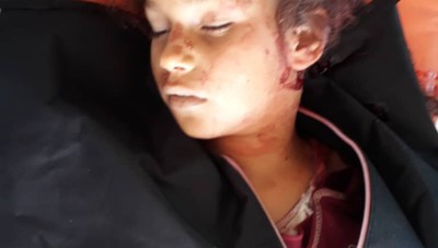 مقتل طفلة بطقلة قناص من النظام في مدينة الباب