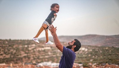 طفل سوري يعود لبلاده بعد تركيب أطراف اصطناعية في تركيا
