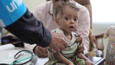 الأمم المتحدة تحذّر: كل 10 دقائق يموت طفل في اليمن