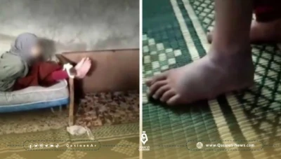 بعد تسريب فيديو للحادثة .. إلقاء القبض على رجل قام بتعذيب ابنة زوجته في مدينة إدلب